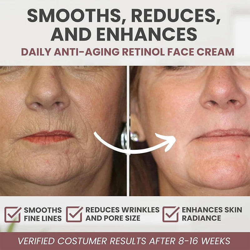 Instant Retinol Cream – Anti-Aging Firming & Whitening Moisturizer