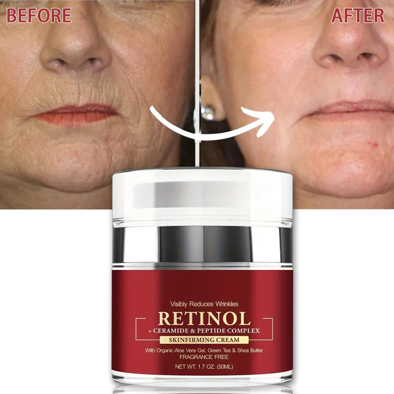 Instant Retinol Cream – Anti-Aging Firming & Whitening Moisturizer